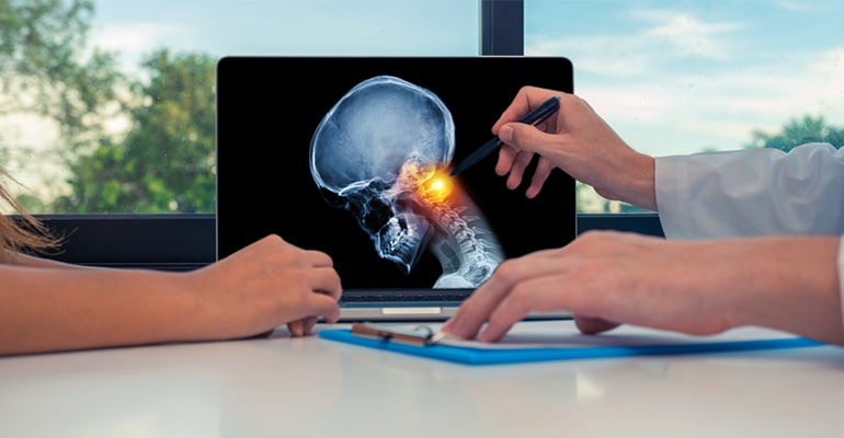 Head and Neck Cancer